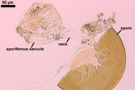 Zdjęcie nr 1 (2)
                                	                                   Acaulospora cavernata. Jeden z najrzadziej występujących gatunków grzybów arbuskularnych na świecie. Zdjęcie przestawia rozgnieciony zarodnik.
                                  